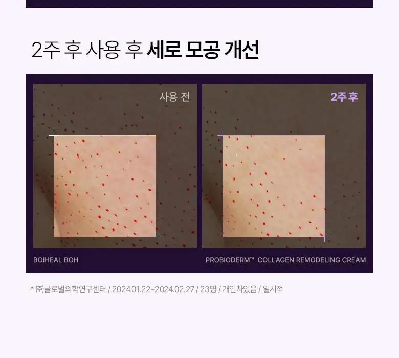 [모공고민|화잘먹] 바이오힐보 프로바이오덤 콜라겐 리모델링 크림 기획세트 [단품/증정기획] 상세페이지 15